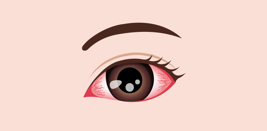 眼睛红.png