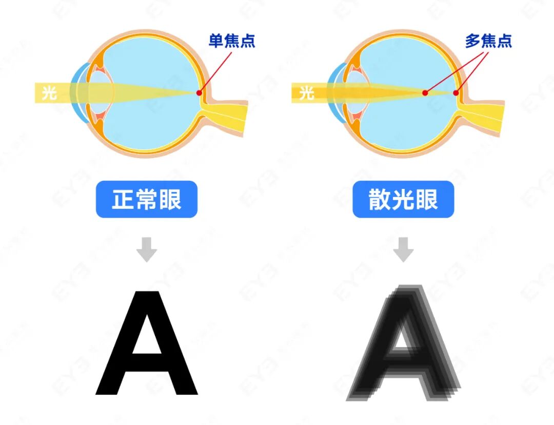 单焦多焦.jpg