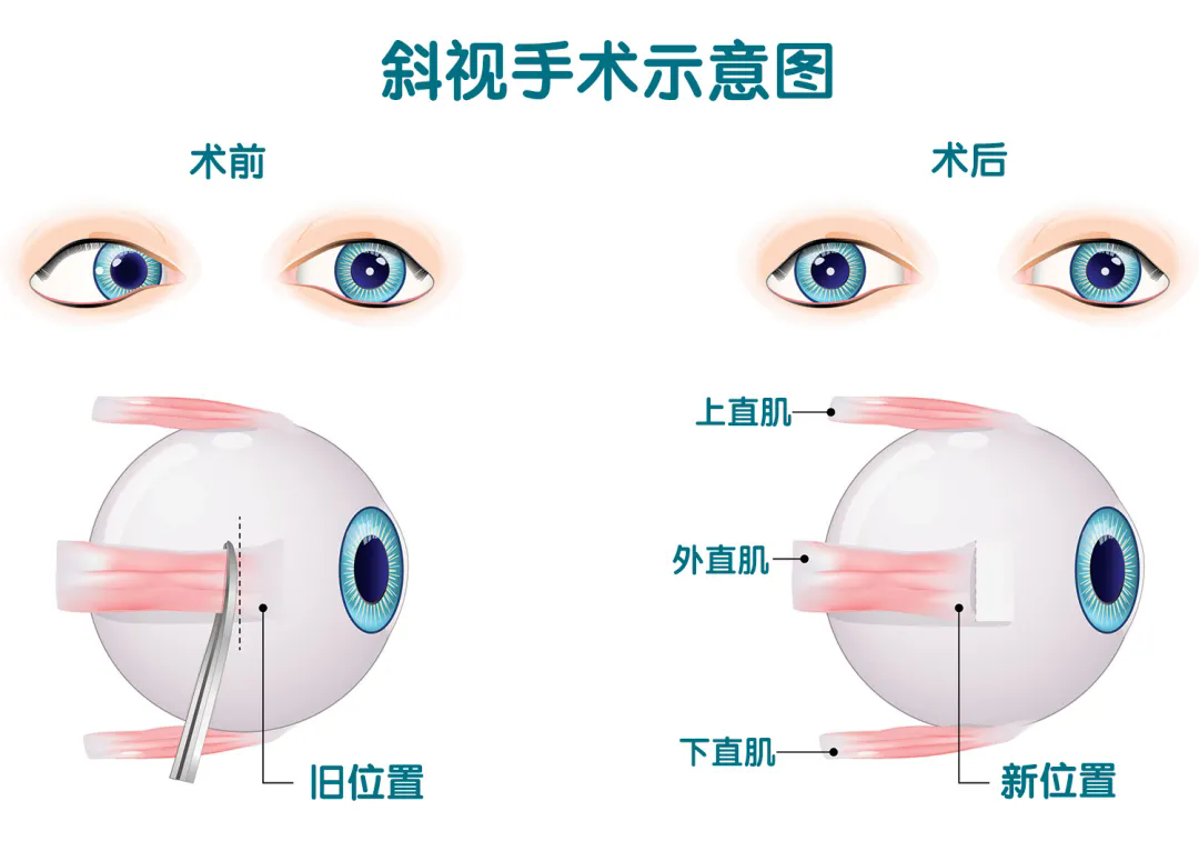 640_wx_fmt=png&from=appmsg&tp=webp&wxfrom=5&wx_lazy=1.webp (1).png