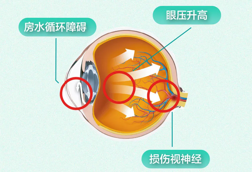 640_wx_fmt=jpeg&from=appmsg&tp=webp&wxfrom=5&wx_lazy=1.webp (1).png