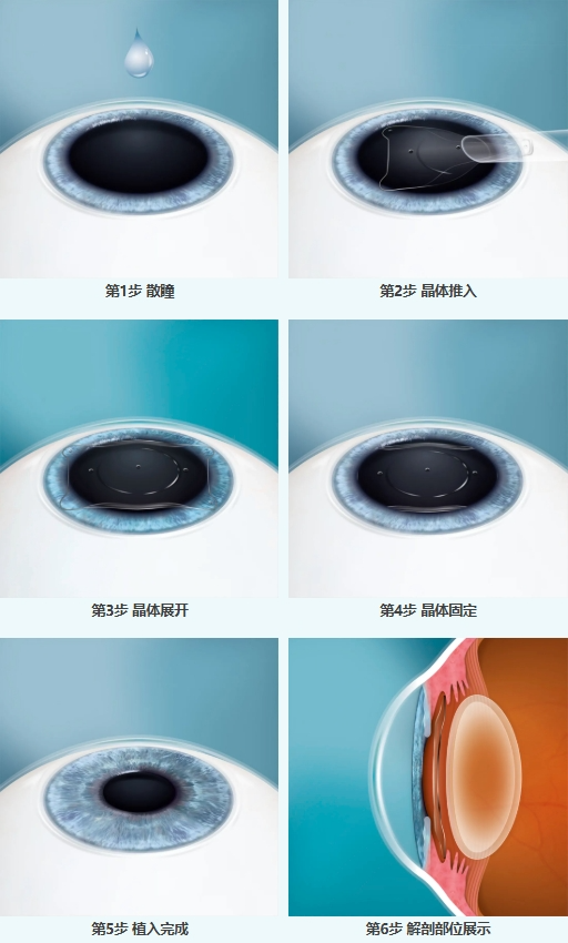 微信图片_2026-04-13_113851_388.png