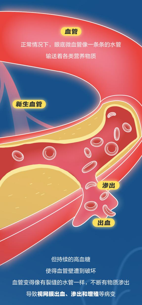 控糖2.png
